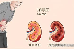 曼联伤病情况统计：卢克-肖、奥纳纳、马拉西亚暂无归期